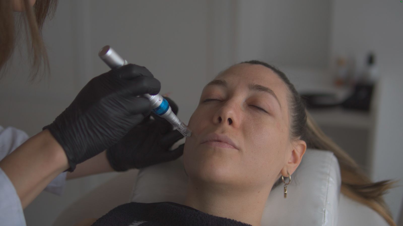 Rejuvenecimiento facial